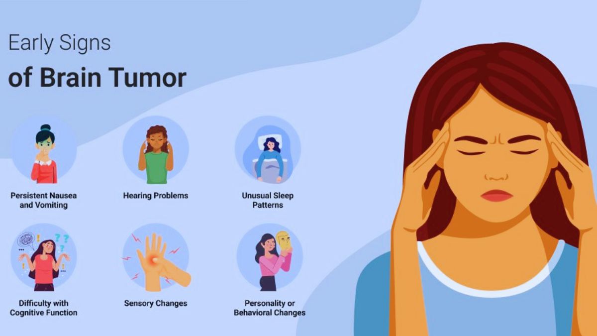 Brain tumor, MRI, cancer, radiotherapy