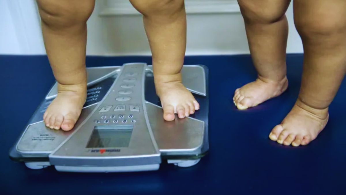 UNICEF, Malnutrition, Obesity, Junk food